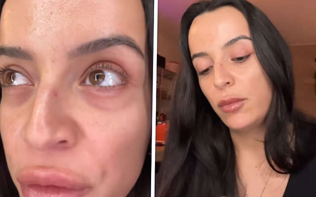 Influencer leert vrouwelijke volgers hoe ze hun belager kunnen verminken